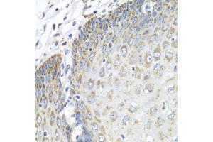 Immunohistochemistry of paraffin-embedded human esophagus using TMOD3 antibody (ABIN1683055, ABIN3019135, ABIN3019136 and ABIN6220733) at dilution of 1:100 (40x lens). (TMOD3 Antikörper  (AA 1-352))