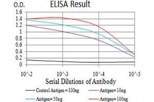 Black line: Control Antigen (100 ng);Purple line: Antigen (10ng); Blue line: Antigen (50 ng); Red line:Antigen (100 ng) (P2RX7 Antikörper  (AA 226-452))