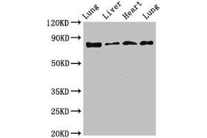 Western Blot Positive WB detected in: Rat lung tissue, Rat liver tissue, Mouse heart tissue, Mouse lung tissue All lanes: LOXL2 antibody at 3. (LOXL2 Antikörper  (AA 27-121))