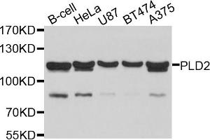 Western blot analysis of extracts of various cell lines, using PLD2 antibody. (Phospholipase D2 Antikörper)