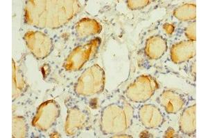 Immunohistochemistry of paraffin-embedded human thyroid tissue using ABIN7169924 at dilution of 1:100