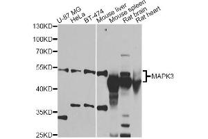 Western blot analysis of extracts of various cell lines, using MAPK8 antibody (ABIN1873631) at 1:1000 dilution. (JNK Antikörper)