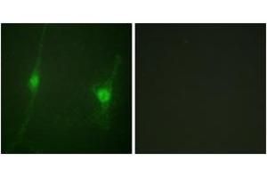 Immunofluorescence analysis of NIH-3T3 cells, using LKB1 (Ab-428) Antibody. (LKB1 Antikörper  (AA 384-433))
