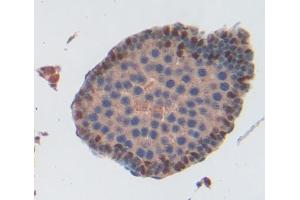 Used in DAB staining on fromalin fixed paraffin- embedded testis tissue (ABCA9 Antikörper  (AA 1416-1583))