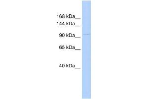 WB Suggested Anti-COL6A1  Antibody Titration: 0. (COL6A1 Antikörper  (Middle Region))