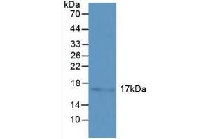 Detection of HSPb3 in Human Liver Tissue using Polyclonal Antibody to Heat Shock Protein Beta 3 (HSPb3) (HSPB3 Antikörper  (AA 1-150))