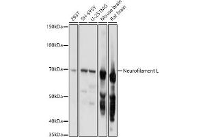 Western blot analysis of extracts of various cell lines, using Neurofilament L antibody (ABIN3020808, ABIN3020809, ABIN3020810 and ABIN6213733) at 1:1000 dilution. (NEFL Antikörper  (AA 400-543))