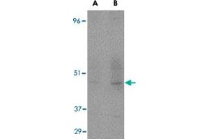 Western blot detection of CD209 fusion protein in human placenta at (A) 1 and (B) 2 ug/mL . (DC-SIGN/CD209 Antikörper)