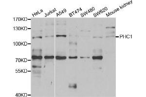 Western blot analysis of extracts of various cell lines, using PHC1 antibody. (PHC1 Antikörper)