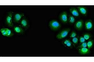 Immunofluorescent analysis of A549 cells using ABIN7144062 at dilution of 1:100 and Alexa Fluor 488-congugated AffiniPure Goat Anti-Rabbit IgG(H+L) (ZFAND6 Antikörper  (AA 1-208))