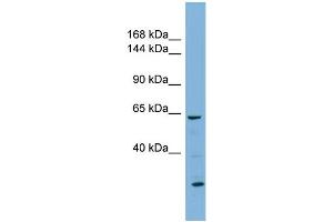 WB Suggested Anti-KL Antibody Titration:  0. (Klotho Antikörper  (N-Term))