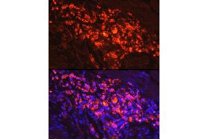 Immunofluorescence analysis of human colon carcinoma cells using Myeloperoxidase (MPO) Rabbit pAb (ABIN6128315, ABIN6143964, ABIN6143965 and ABIN6217844) at dilution of 1:50 (40x lens). (Myeloperoxidase Antikörper  (AA 50-310))