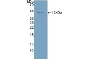 Detection of Recombinant CLEC4L, Human using Polyclonal Antibody to Cluster Of Differentiation 209 (CD209) (DC-SIGN/CD209 Antikörper  (AA 70-404))