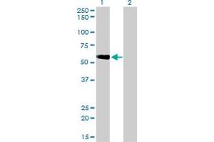 Western Blotting (WB) image for anti-Target of Myb 1 (TOM1) (AA 394-491) antibody (ABIN564328)