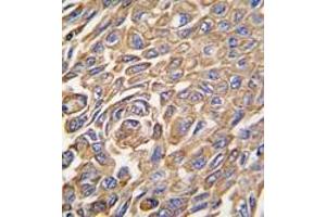 Image no. 2 for anti-Aldehyde Dehydrogenase 3 Family, Member A1 (ALDH3A1) (Middle Region) antibody (ABIN360203)