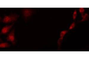 ABIN6267659 staining HepG2 by IF/ICC. (SMAD2 Antikörper  (pSer250))