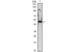 Western Blot showing EGR1 antibody used against EGR1 (AA: 282-433)-hIgGFc transfected HEK293 (1)cell lysate. (EGR1 Antikörper  (AA 282-433))