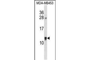Western blot analysis in MDA-MB453 cell line lysates (35ug/lane). (ACBD7 Antikörper  (C-Term))