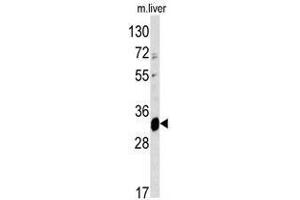 Image no. 1 for anti-ELOVL Fatty Acid Elongase 6 (ELOVL6) (N-Term) antibody (ABIN452952) (ELOVL6 Antikörper  (N-Term))
