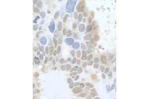 Immunohistochemistry (IHC) image for anti-Discs, Large (Drosophila) Homolog-Associated Protein 5 (DLGAP5) (AA 200-250) antibody (ABIN7453633)