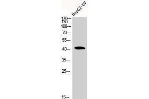 Western Blot analysis of HEPG2-UV cells using Actin α1 Polyclonal Antibody (Actin Antikörper  (N-Term))