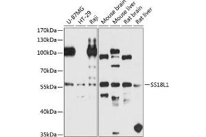 Western blot analysis of extracts of various cell lines, using SS18L1 antibody (ABIN6132117, ABIN6148475, ABIN6148476 and ABIN6224807) at 1:1000 dilution. (SS18L1 Antikörper  (AA 90-270))
