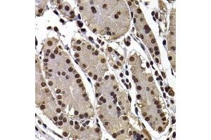 Immunohistochemistry of paraffin-embedded human stomach using GPS1 antibody (ABIN5974162) at dilution of 1/100 (40x lens). (GPS1 Antikörper)