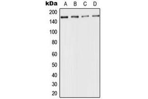 Western blot analysis of CD143 expression in HeLa (A), mouse kidney (B), rat liver (C), PC12 (D) whole cell lysates. (Angiotensin I Converting Enzyme 1 Antikörper  (Center))