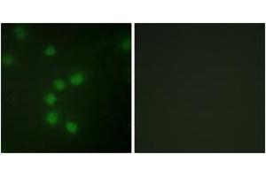 Immunofluorescence analysis of HuvEc cells, using Telomerase (Ab-227) Antibody. (TERT Antikörper  (AA 196-245))