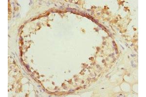 Immunohistochemistry of paraffin-embedded human testis tissue using ABIN7175319 at dilution of 1:100 (VPS4A Antikörper  (AA 1-120))