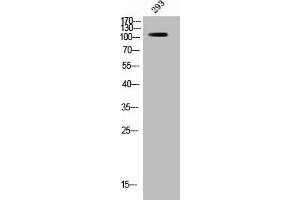 Western Blot analysis of 293 cells using Phospho-Raf-B (S446) Polyclonal Antibody (BRAF Antikörper  (pSer446))