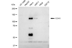 Western blotting analysis using CDH1 antibody (ABIN7797819).
