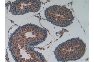 Used in DAB staining on fromalin fixed paraffin- embedded kidney tissue (Lactate Dehydrogenase A Antikörper  (AA 1-332))