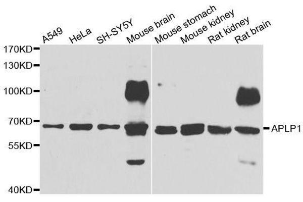 APLP1 Antikörper  (AA 39-300)