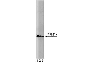 Western blot analysis of UbcH7 on a Jurkat cell lysate (Human T-cell leukemia, ATCC TIB-152).