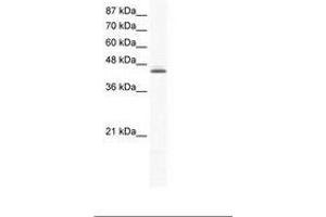 Image no. 1 for anti-ALX Homeobox 4 (ALX4) (C-Term) antibody (ABIN6736020) (ALX4 Antikörper  (C-Term))