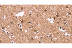 Immunohistochemistry of paraffin-embedded Human brain using HSD17B1 Polyclonal Antibody at dilution of 1:40 (HSD17B1 Antikörper)
