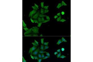 Immunofluorescence analysis of MCF7 cells using HABP2 Polyclonal Antibody (HABP2 Antikörper)