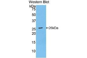 Western blot analysis of recombinant Mouse Bcl2. (Bcl-2 Antikörper  (AA 2-208))