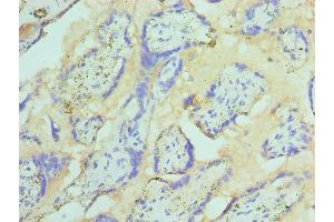 Immunohistochemistry of paraffin-embedded human placenta tissue using ABIN7171018 at dilution of 1:100 (ST14 Antikörper  (AA 566-855))