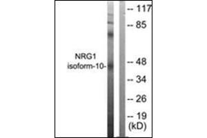 Western blot analysis of extracts from SKOV3 cells, using NRG1 isoform-10 Antibody. (Neuregulin 1 Antikörper  (Isoform 10, N-Term))