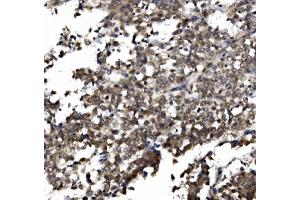 IHC analysis of TORC1/CRTC1 using anti-TORC1/CRTC1 antibody (ABIN7602801). (CRTC1 Antikörper  (C-Term))