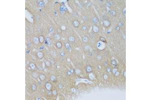 Immunohistochemistry of paraffin-embedded mouse brain using VSNL1 antibody. (VSNL1 Antikörper  (AA 1-191))