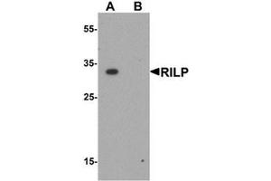 Western blot analysis of RILP in A20 cell lysate with RILP antibody at 1 ug/mL. (RILP Antikörper  (Middle Region))