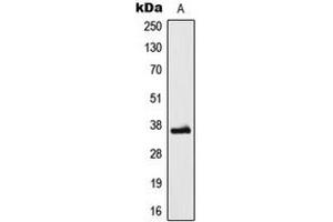 Western Blotting (WB) image for anti-Low Density Lipoprotein Receptor Class A Domain Containing 3 (LDLRAD3) (Center) antibody (ABIN7299728)