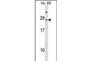 LY96 Antibody (C-term) (ABIN1536634 and ABIN2849030) western blot analysis in HL-60 cell line lysates (35 μg/lane). (LY96 Antikörper  (C-Term))