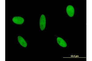 Immunofluorescence (IF) image for anti-GLI Family Zinc Finger 3 (GLI3) (AA 1-110) antibody (ABIN561053)