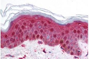 Human Skin (formalin-fixed, paraffin-embedded) stained with BRD2 antibody ABIN214728 at 5 ug/ml followed by biotinylated goat anti-rabbit IgG secondary antibody ABIN481713, alkaline phosphatase-streptavidin and chromogen. (BRD2 Antikörper  (AA 524-573))