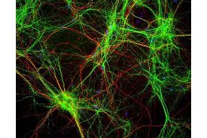 Mixed neuron/glia cultures stained with ABIN1580434 (green) and also rabbit antibody of neurofilament NF-H RPCA-NF-H (red). (MAP2 Antikörper)