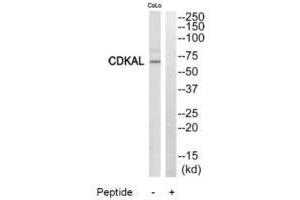 Western blot analysis of extracts from COLO205 cells, using CDKAL antibody. (CDKAL1 Antikörper  (N-Term))